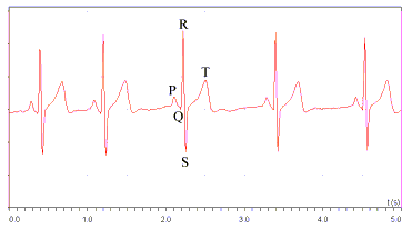 Resting ECG